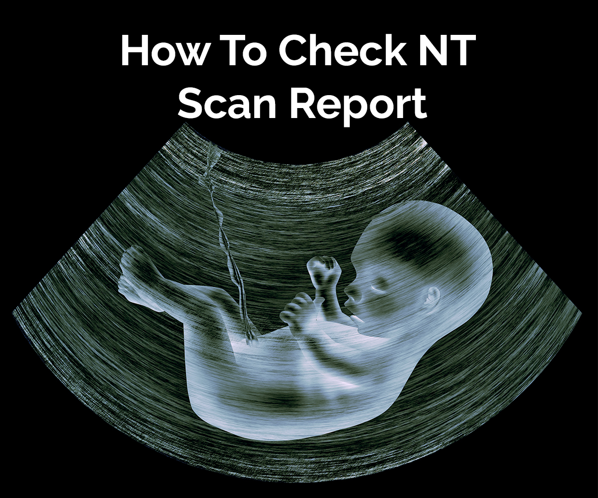 nt scan meaning in tamil